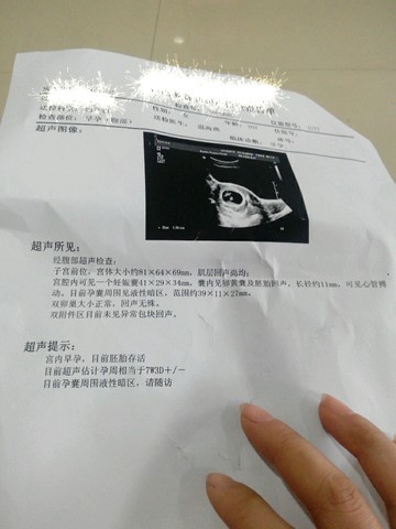 journal_insert_pic_178514519