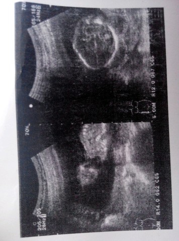 journal_insert_pic_185980534