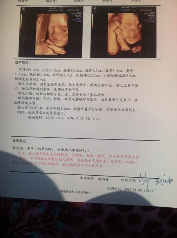 journal_insert_pic_186909049