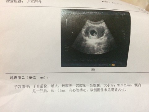 journal_insert_pic_187711564