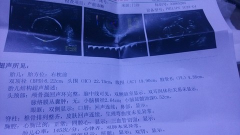 journal_insert_pic_188084410