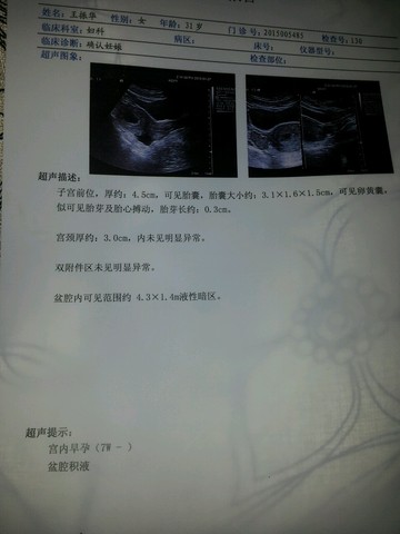journal_insert_pic_194885939