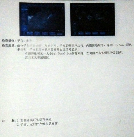 journal_insert_pic_198848524