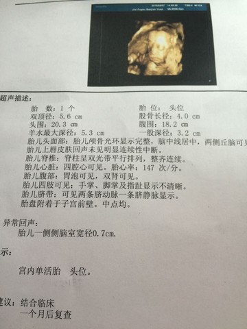 journal_insert_pic_205079631