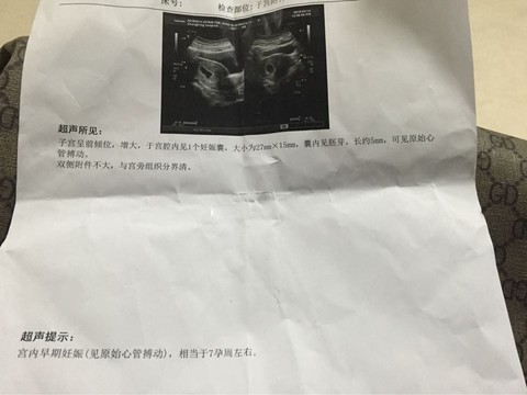 journal_insert_pic_207670747
