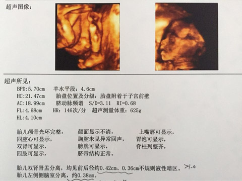 journal_insert_pic_208449393