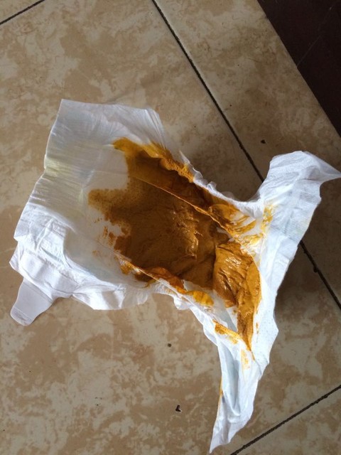 纯喝母乳的宝宝大便应该是什么样的?