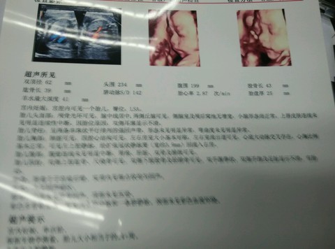 journal_insert_pic_208830430
