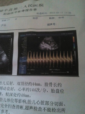 journal_insert_pic_208858916
