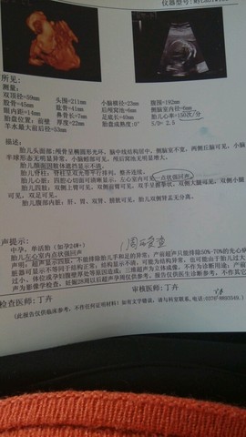 journal_insert_pic_210751889