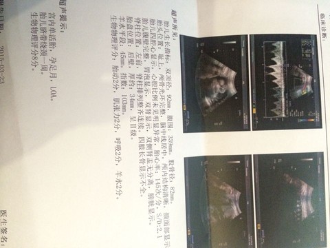 journal_insert_pic_211021767