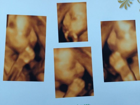 journal_insert_pic_212390512