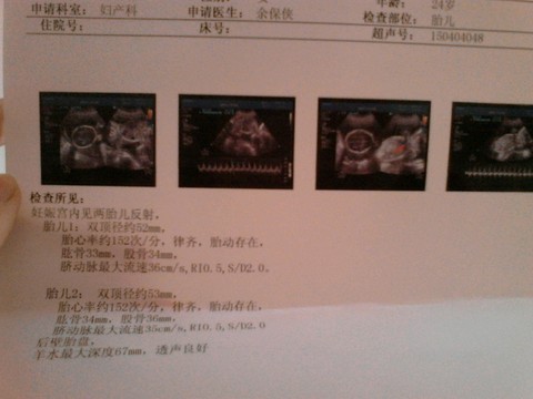 journal_insert_pic_217427607