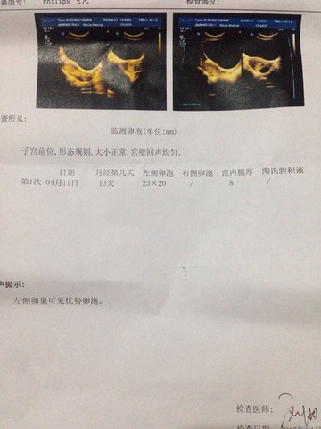 journal_insert_pic_218801131