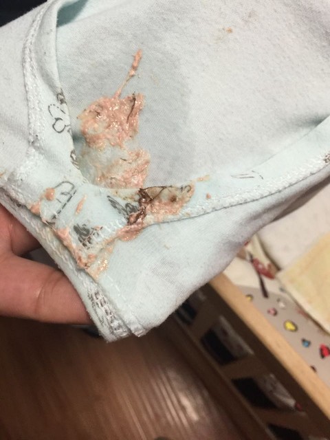 有宝宝吐奶吐出咖啡色的吗