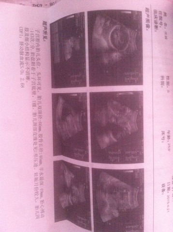 journal_insert_pic_222983993