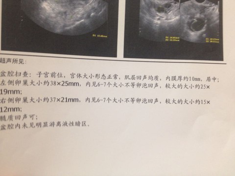 journal_insert_pic_223050345