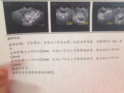 journal_insert_pic_223050329