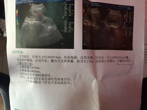 journal_insert_pic_223913545