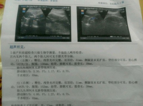 journal_insert_pic_228983610