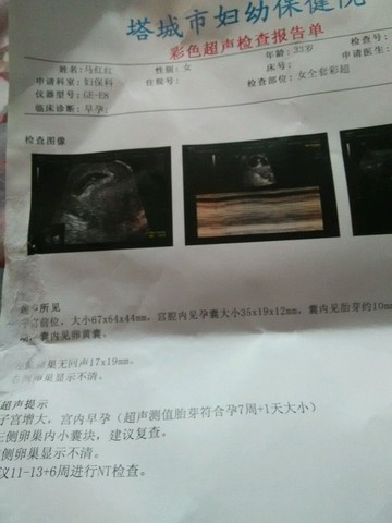 journal_insert_pic_231665546