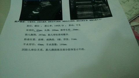 journal_insert_pic_232346209
