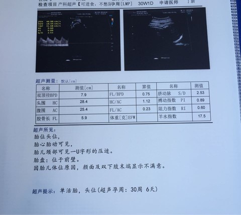 journal_insert_pic_232889670