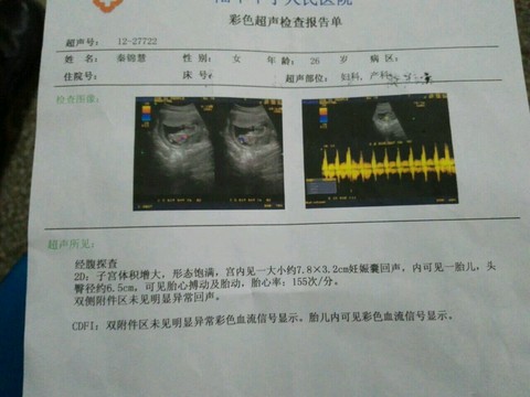journal_insert_pic_235018387