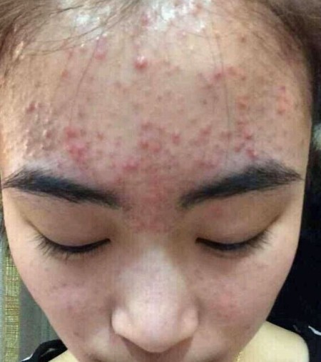 我想请教一下怀孕的妈妈们,孕妇能吃烧烤吗?