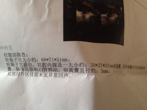 journal_insert_pic_241534861