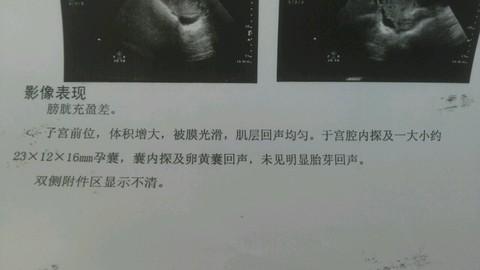 journal_insert_pic_245917989