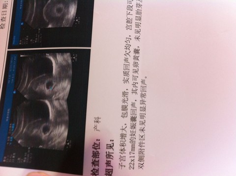 journal_insert_pic_247098128