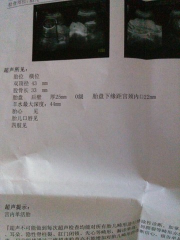 journal_insert_pic_251476122