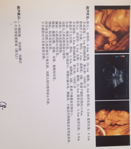 journal_insert_pic_259905569