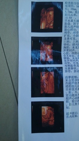 journal_insert_pic_262409309