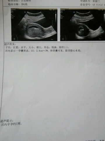 journal_insert_pic_263102221