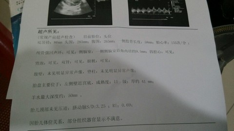 journal_insert_pic_264352907