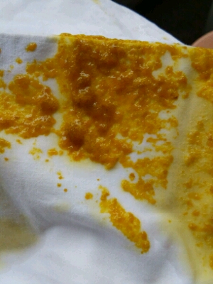 前俩天一直拉稀,一天六次,我看他拉的时候好多沫