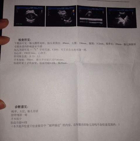 journal_insert_pic_268386053