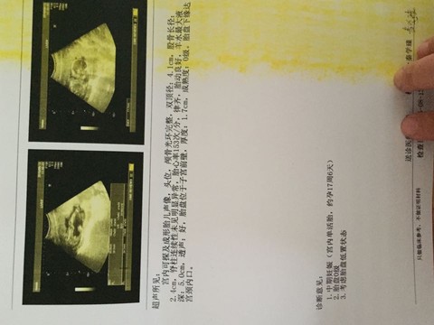 journal_insert_pic_269824500