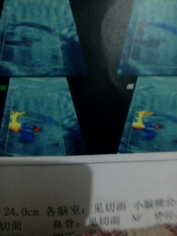 journal_insert_pic_277963806