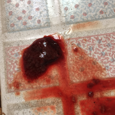 怀孕初期流出一坨血肉图片