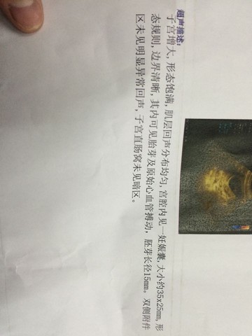 journal_insert_pic_285037856