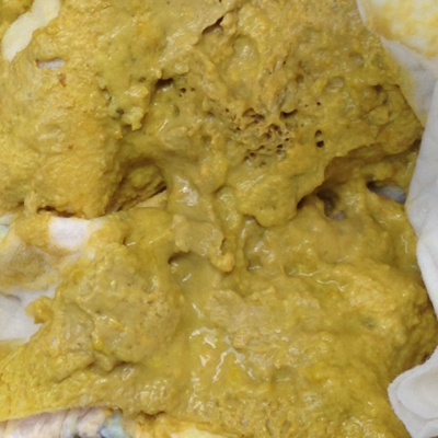 有图慎入,腹泻奶粉转羊奶粉期间,这样的大便正常吗