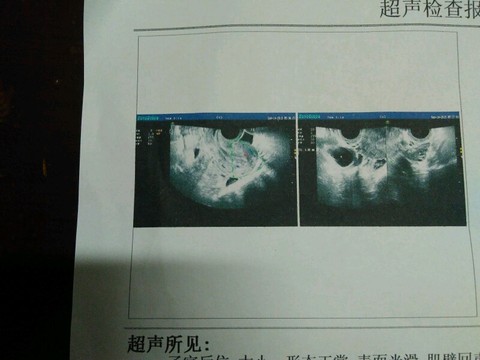 journal_insert_pic_295311087