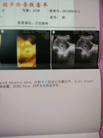 journal_insert_pic_295235234