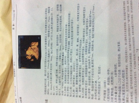 journal_insert_pic_297359992