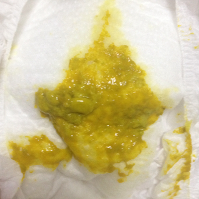 应该不是奶瓣吧