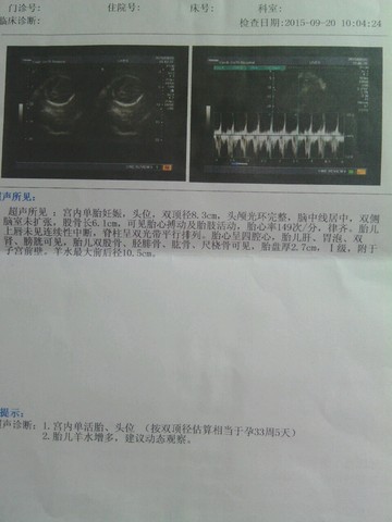 journal_insert_pic_300268571