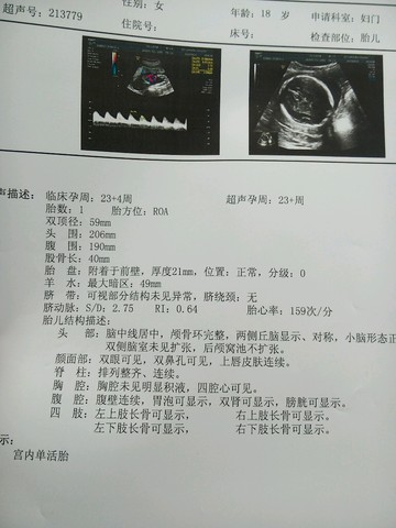 journal_insert_pic_301620759